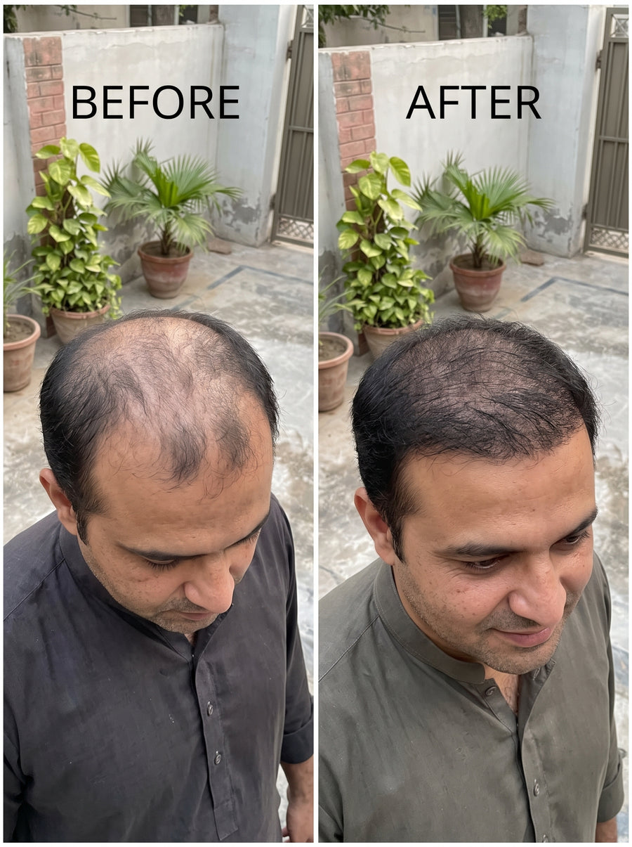 Hair Growth Oil
